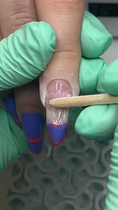 Super Broken Nail 🤪 #nails #manicure #nailrepair #brokennail #nailtutorial #nailtips