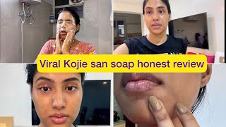 Skin lightening soap?? | Kojie san soap most honest review| Yashi Tank