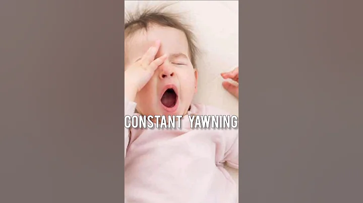 Signs of Evil eye in Islam 😰☪️ #shorts #islam #youtubeshorts