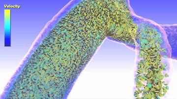 Multiscale Hemodynamics Project