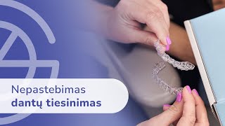 Pasakoja Burnos Chirurgas - Marijus Strazdas Dantų Tiesinimas Kapomis