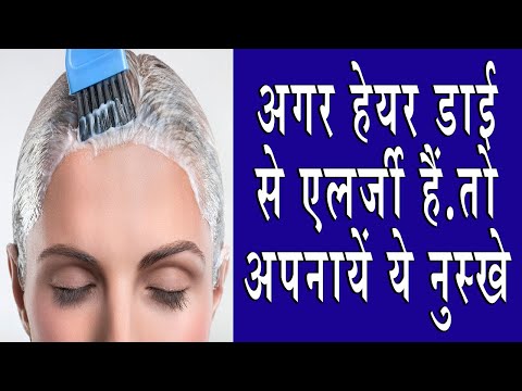 अगर हेयर डाई से एलर्जी हैं...तो अपनायें ये नुस्खे.. |  HOME REMEDIES FOR HAIR DYE ALLERGIES