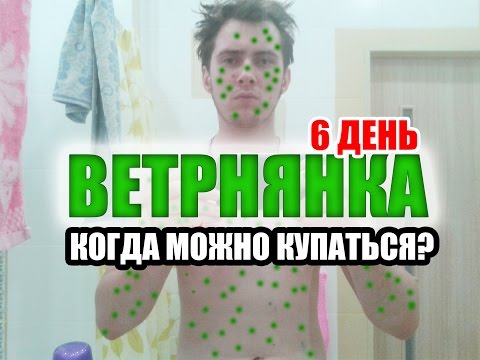 ВЕТРЯНКА КОГДА МОЖНО КУПАТЬСЯ? 6 день