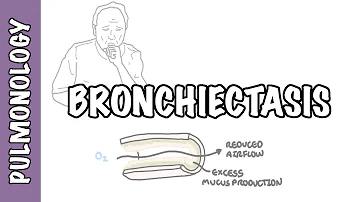 Co je příčinou bronchiektázie?