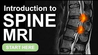 How to Read Spine MRI: Anatomy & Approach