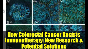 How Colorectal Cancer Resists Immunotherapy: New Research & Potential Solutions