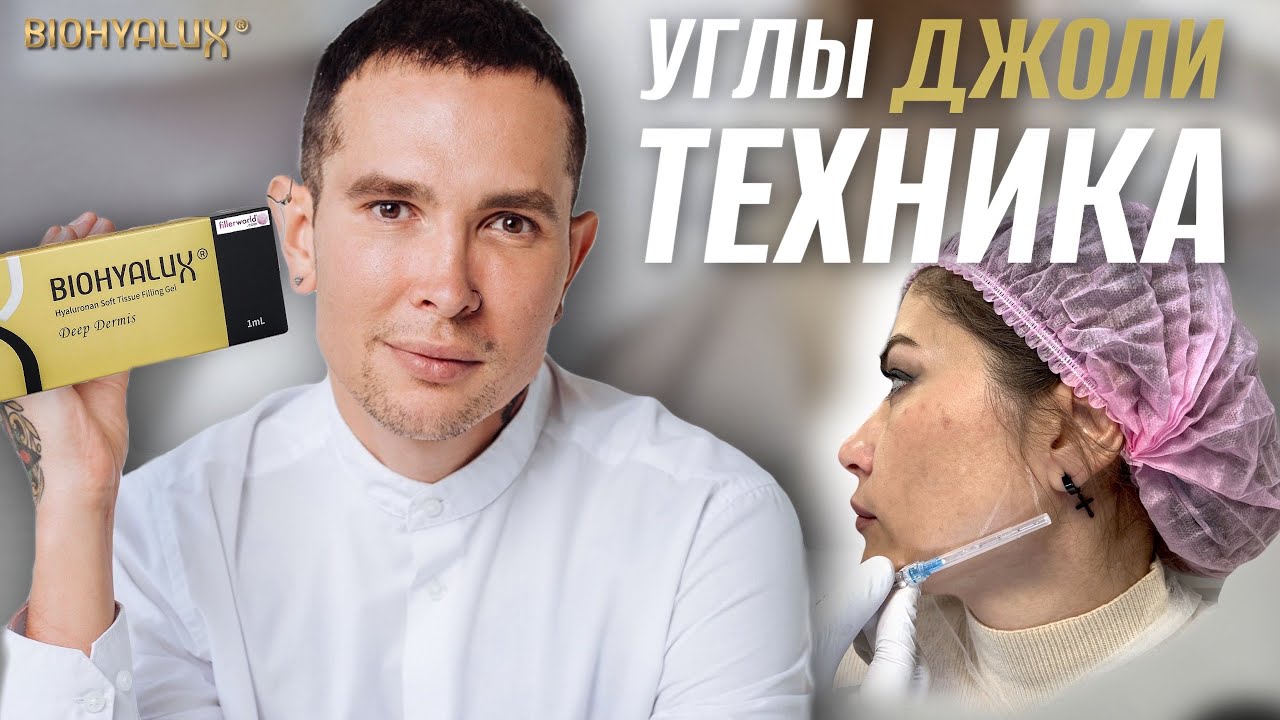 УГЛЫ ДЖОЛИ | СКУЛЫ контурная пластика #скулы #углыджоли #biohyalux