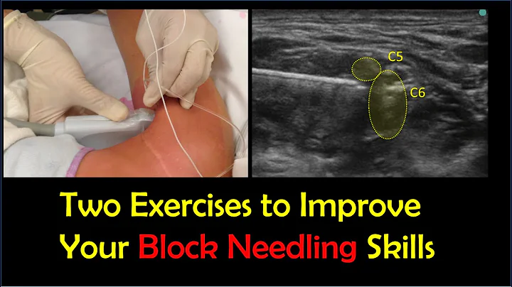 Improve Your Needle Handling in USG-PNB With These TWO Exercises