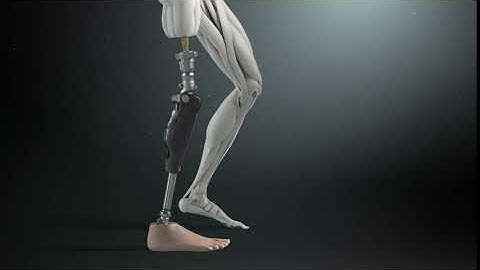 Osseointegration for above knee amputees animation