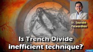 293 Is Trench Divide Inefficient Technique? Dr Sourabh Patwardhan