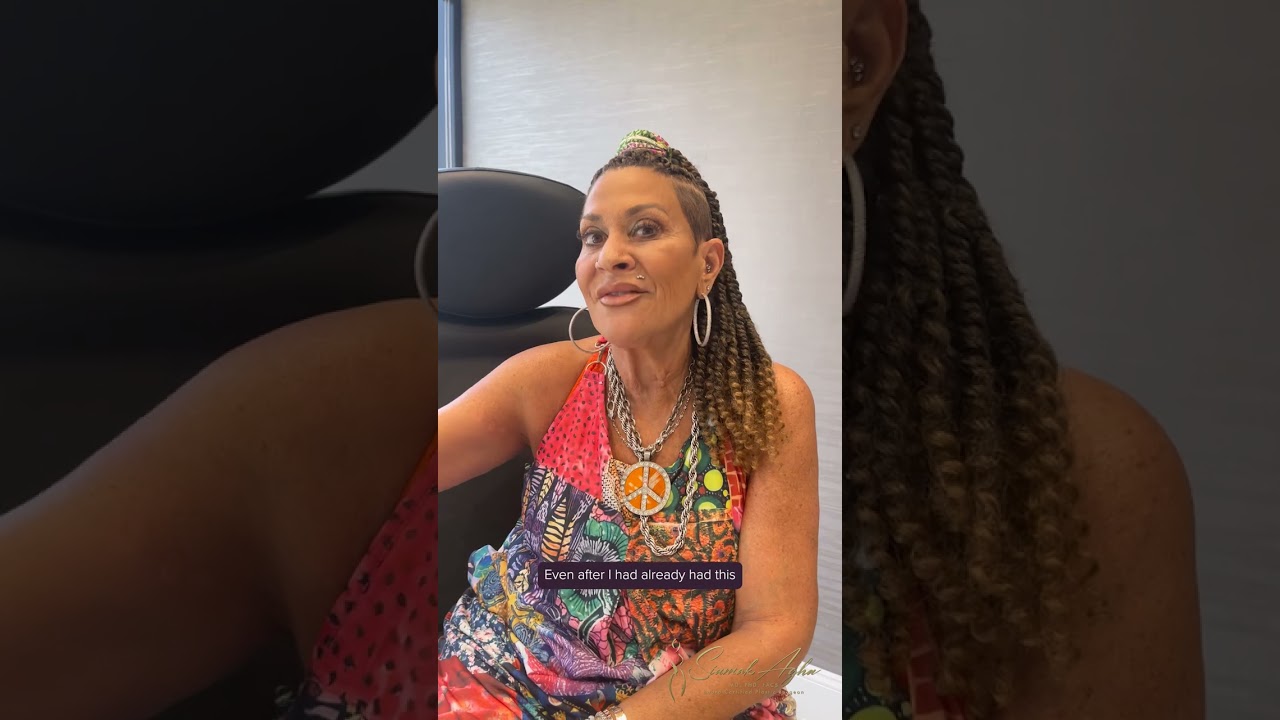 One Month Post Op Arm Lift Redo & Breast Fat Transfer