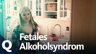 Fetales Alkoholsyndrom: Hirnschäden durch Alkohol in Schwangerschaft | Quarks