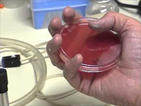 Bacterial streaking on blood agar