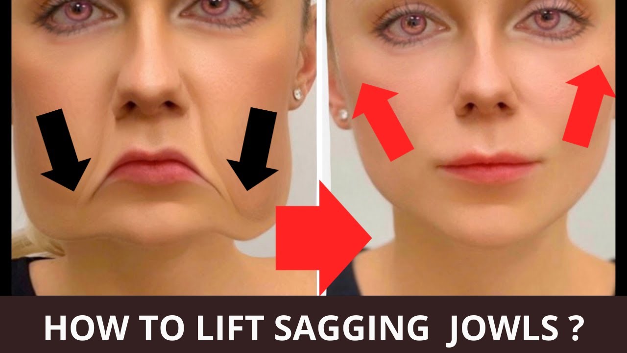 🛑 FACE LIFTING EXERCISES FOR JOWLS &amp; LAUGH LINES !| (NASOLABIAL FOLDS) SAGGY SKIN, LIFT SAGGY ...