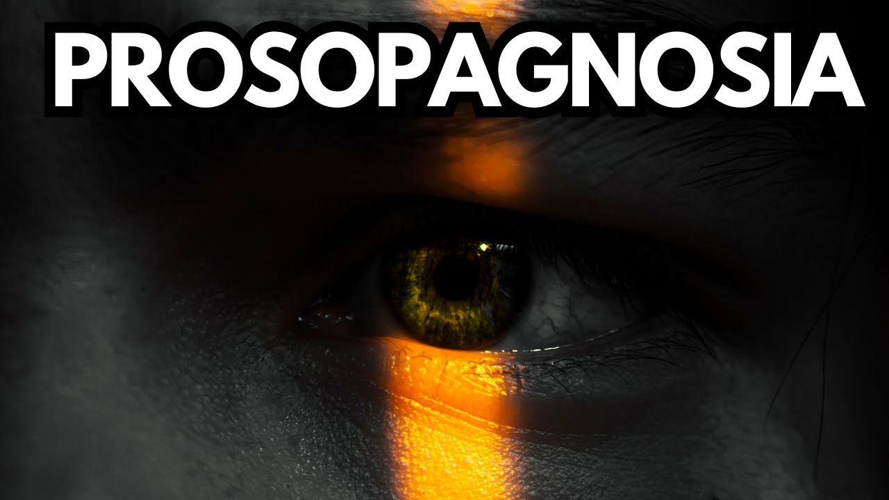 Understanding Prosopagnosia | Face Blindness Explained - YouTube