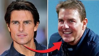Tom Cruise Plastic Surgery: FULL FACE Reconstruction YOU Didn't Notice