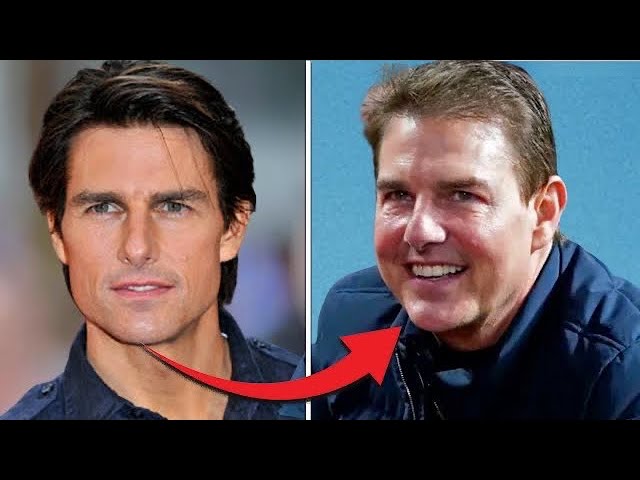 Tom Cruise Plastic Surgery: Full Face Reconstruction You Didn'T Notice -  Youtube