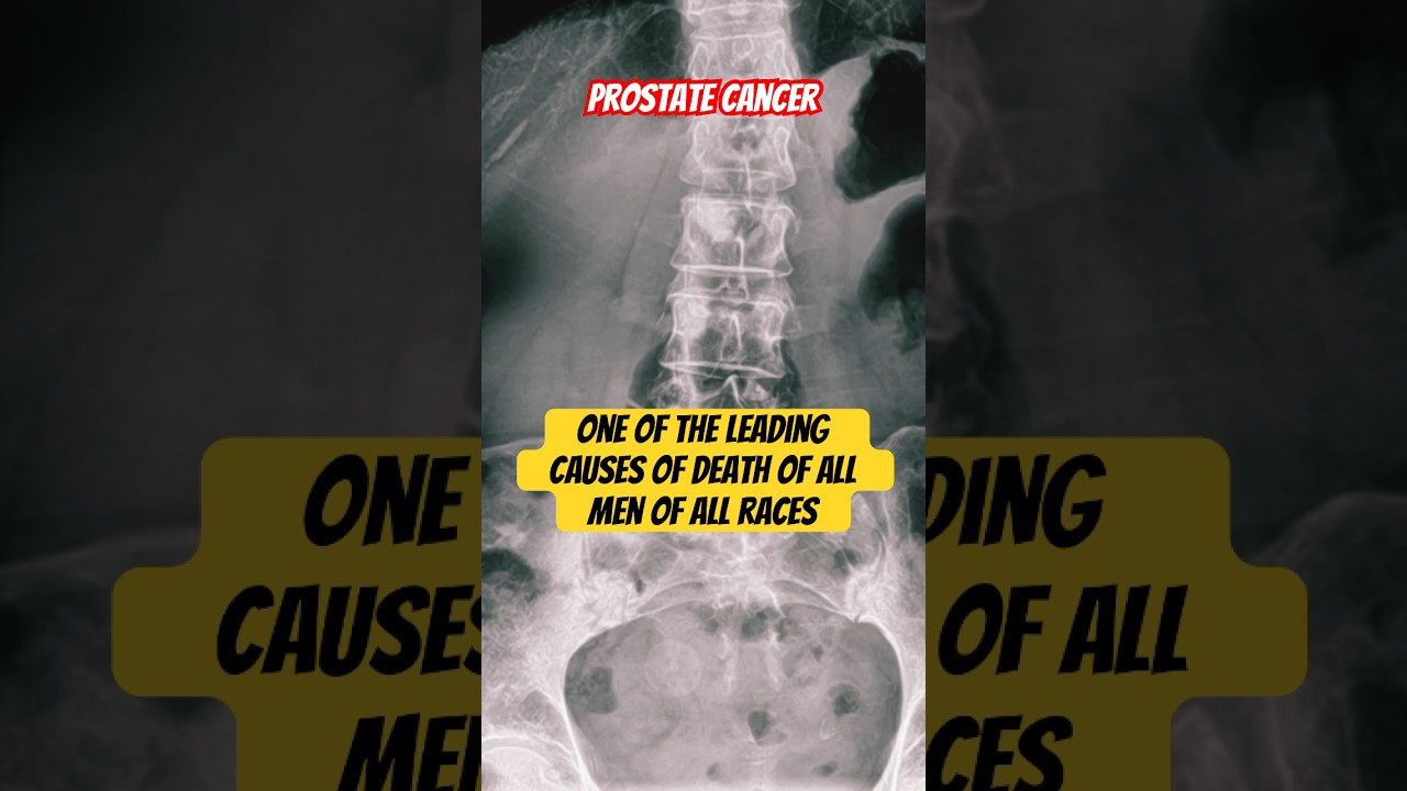 Prostate Cancer 🩻 
