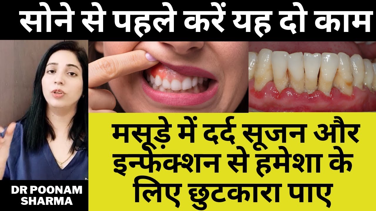 मसूड़े में दर्द,सूजन,इन्फेक्शन,के 2 घरेलु उपाय | Home Remedies For Gum Infection   || 