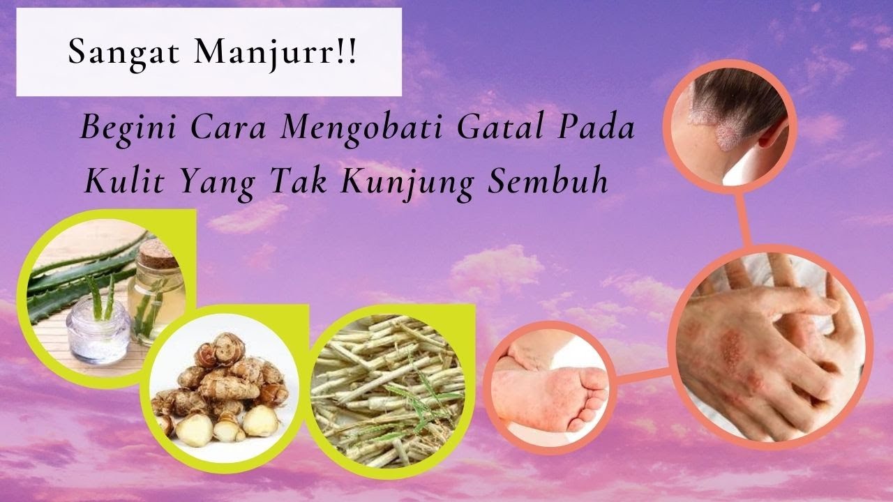 Sangat Manjurr!! Begini Cara Mengobati Gatal Pada Kulit Yang Tak