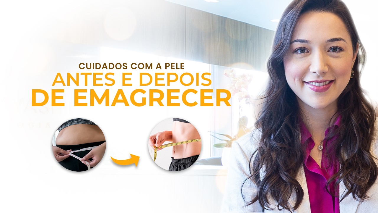 Como manter a PELE FIRME antes e depois de EMAGRECER! - YouTube
