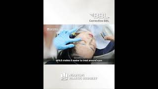 BBL 색소 시술이란? | What is Corrective BBL?