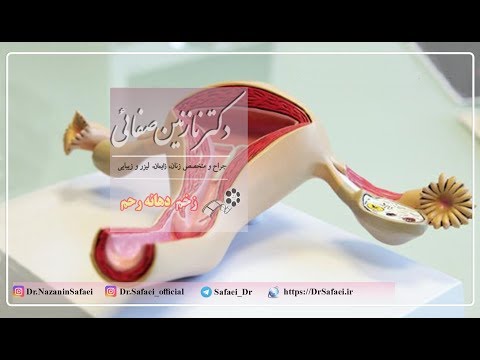 تصویری: نحوه بررسی مخاط دهانه رحم: 11 مرحله (همراه با تصاویر)