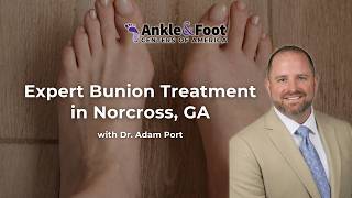 Expert Bunion Treatment in Norcross, GA | Ankle & Foot Centers of America