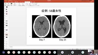 脳神経外科臨床講義（医学科模擬授業）