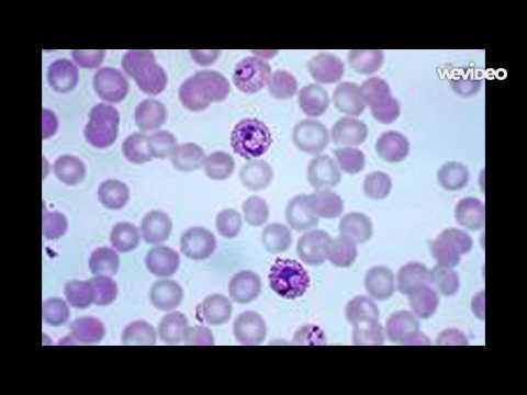 Video: Effect Van Voedingsbestanddelen Op MiRNA En Colorectale Carcinogenese