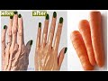 Remove wrinkles from hands in 3 days completely fast, soft hands remedy, wrinkled hands home remedy