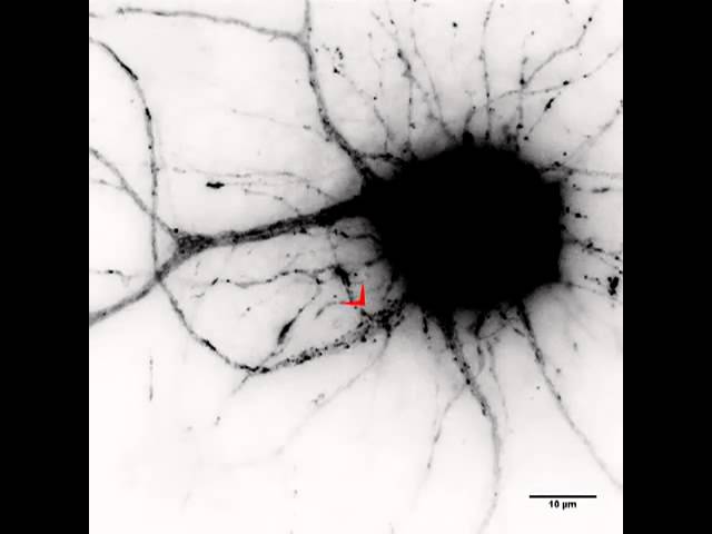 Из жизни одного нейрона