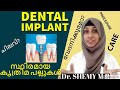 Is DENTAL IMPLANT painful? (2021) ||കൃത്രിമ ദന്തങ്ങള്‍ വേദനിക്കുമോ?|| Dr SHEMY M R