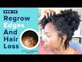 How To Regrow Edges On Natural Hair FAST & EASY | Tips for Hair Loss & Repair