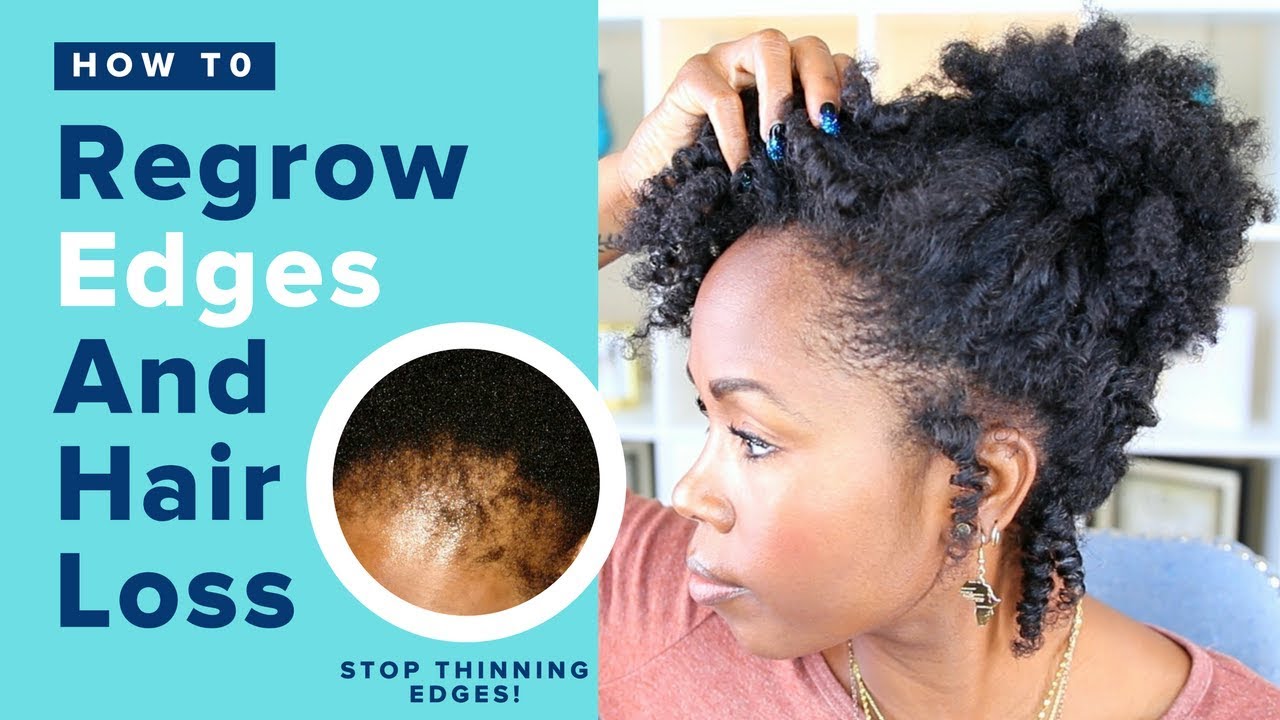 28 Cute How to style hair with bald edges 