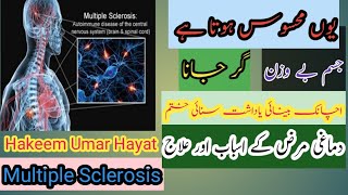 Treatment of Multiple Sclerosis دماغی مرض کا علاج  Hakeem umar hayat