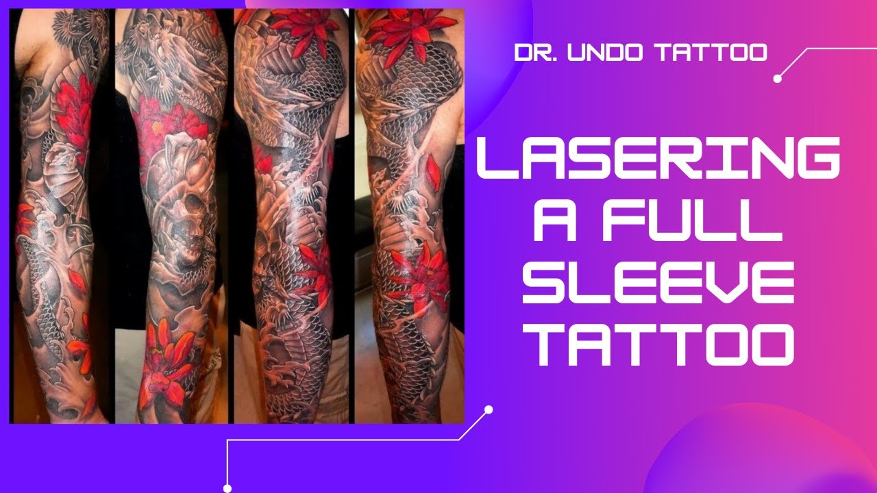 Laser tattoo removal : The Full Sleeve - YouTube