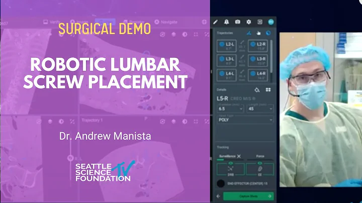 Robotic Lumbar Screw Placement - Andrew Manista, MD