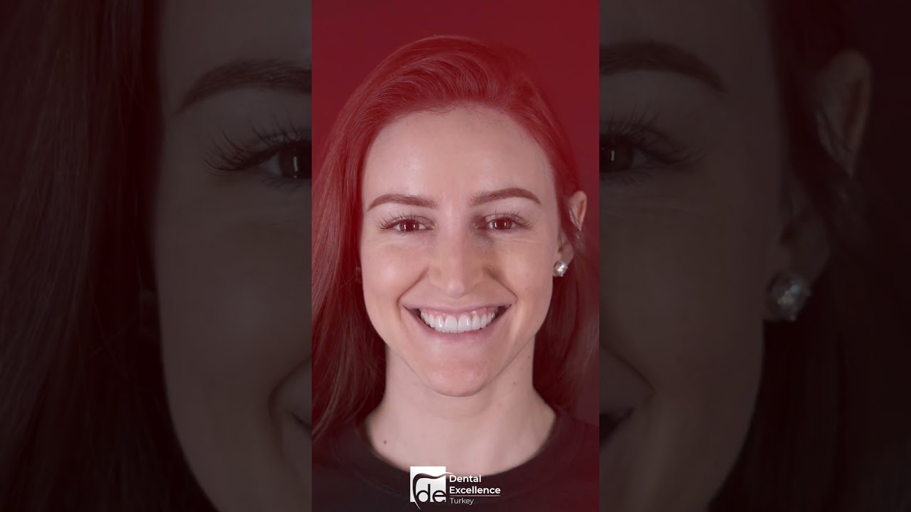 Happy Smiles with Dental Excellence Turkey