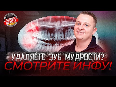 Что нельзя делать после удаления зуба мудрости. Рекомендации Немецкого Имплантологического Центра