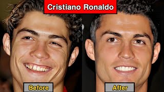25 Celebrities Who (THANKFULLY) Have Had Dental Work 😱 _ Comparison Before And After Celebrities
