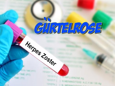 Video: Herpes-Zoster-Inzidenz In Deutschland - Eine Indirekte Validierungsstudie Für Selbst Gemeldete Krankheitsdaten Aus Vorteststudien Der Bevölkerungsbezogenen Deutschen Nationalkohort