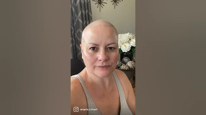 My cancer journey so far - Breast Cancer - Chemotherapy - DayDayNews
