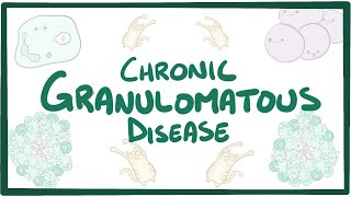 Chronic granulomatous disease  causes, symptoms, diagnosis, treatment, pathology