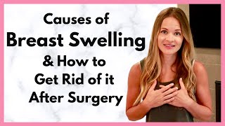 Chest Swelling Causes and How to Treat to reduce Chest Pain after Surgery