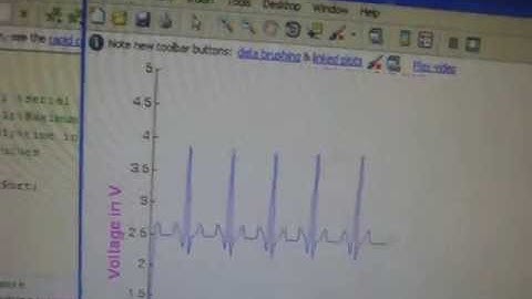 A Cardiac Signal Monitoring and Processing System based on matlab (Rs.8000/-)
