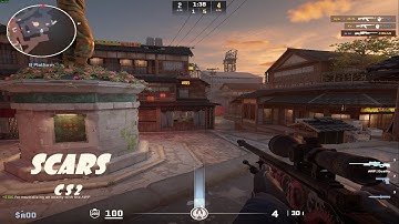 SCARS | cs2