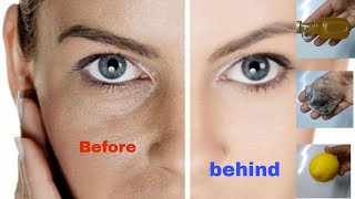 احسن طريقة لتنضيف وتبييض البشرة طبيعيا The best way to cleanse and whiten the skin naturally