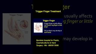 Trigger finger or trigger thumb deformity treatment with A1 Pully & sheath release Plastic Surgery