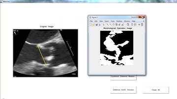 Project Topics Related to Image Processing | Thesis Topics Related to Image Processing